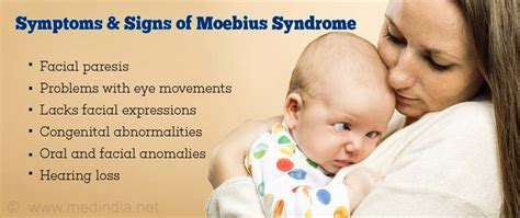 Moebius syndrome is one of the rare disorders amongst the disorders of oromandibular limb hypogenesis with congenital non progressive bilateral or unilateral, complete or partial paralysis of the. Moebius Syndrome - Causes, Symptoms, Diagnosis, Treatment & Prevention