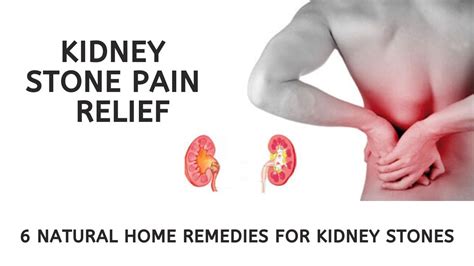 Kidney Stone Pain Relief 6 Natural Home Remedies For Kidney Stones