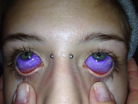 Eyeball Tattoo Beware Of The New Trend From Usa Micro Chirurgia Oculare