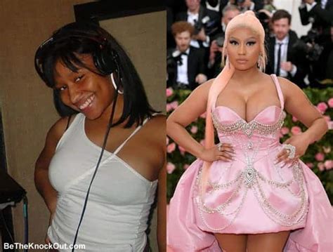 nicki minaj plastic surgery comparison photos