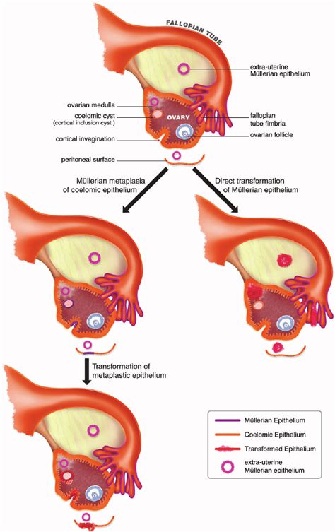 Diagram Of Ovarian And Tubal Anatomy Depicting The Coelomic And