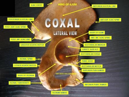 Open book pelvic fracture - WikEM