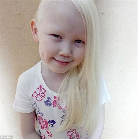 I dyed my hair back black for a number of years but a year ago i decided to go grey. but, my hair is not the great salt and pepper that i expected, it is icy snow white. Snow White: The eight-year-old Siberian albino | Daily ...