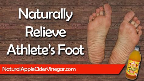 How To Cure Athletes Foot Naturally With Apple Cider Vinegar Youtube