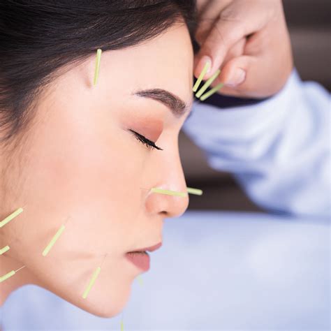 Acupuncture Therapy Acupuncture And Skin Care