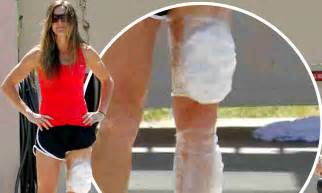 Soccer Player Brandi Chastain Injures Her Leg During Rehearsals For