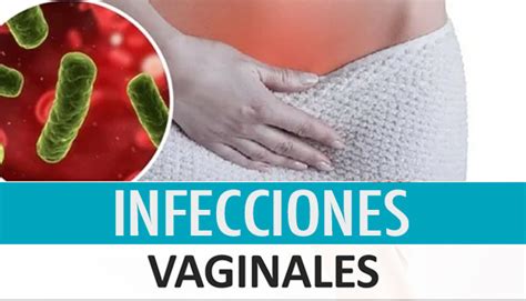 A Que Se Deben Las Infecciones Vaginales Y Como Prevenirlas Cachicha My XXX Hot Girl