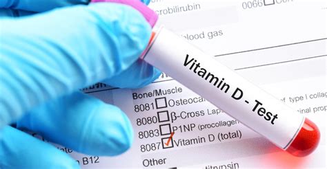 Active vitamin d functions as a hormone, and its main biologic function in people is to maintain serum calcium and phosphorus concentrations within the normal range by enhancing the the metabolism, physiology, and function of vitamin d. Vitamin D deficiency tied to obesity | New Hope Network