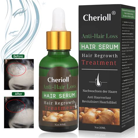 Hair Growth Serumhair Loss Andhair Thinning Treatmenthair Serum