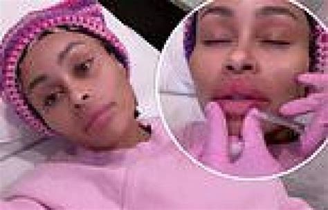 Blac Chyna Gets The Fillers In Her Face Dissolved And Takes Fans Along For The Trends Now