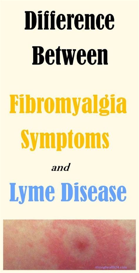 Difference Between Lyme Disease And Fibromyalgia Symptoms