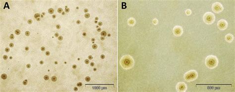 Asymptomatic Infection With Mycoplasma Hominis Negatively Affects Semen