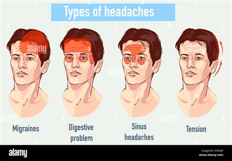 Different Types Of Headaches Different Types Of Headaches Images And