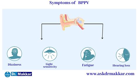 Benign Paroxysmal Positional Vertigo Bppv Symptoms Causes