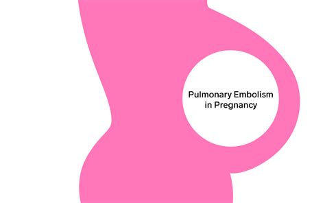Pulmonary Embolism In Pregnancy NUEM Blog