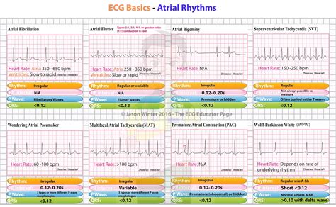 ECG Basics - Atrial Rhythms #Cardiology #MedStudent | GrepMed