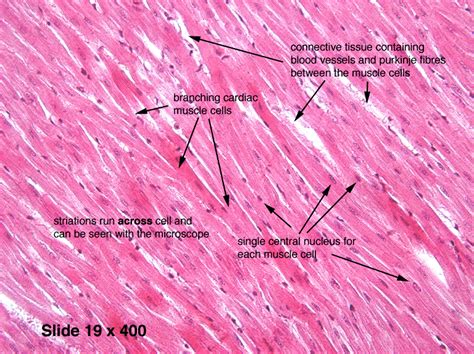 Cardiac muscle (also called heart muscle or myocardium) is one of three types of vertebrate muscle tissue, with the other two being skeletal muscle and smooth muscle. Pin on Histology - Muscle