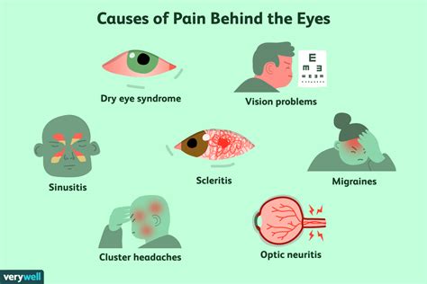 Pain Behind The Eye Symptoms Causes And Treatment