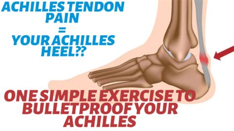 Update 110 Achilles Heel Pain Exercises Super Hot Esthdonghoadian