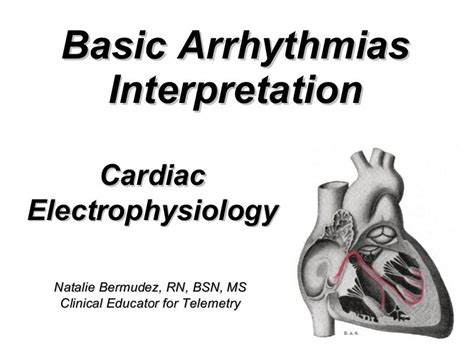 Basic Arrhythmias Interpretation Cardiac Electrophysiology Natalie