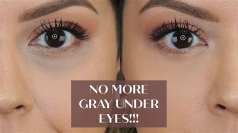 No More Gray Under Eyes How To Conceal Dark Circles Without It Turning Gray Youtube