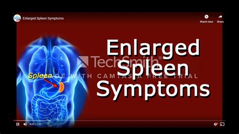 Enlarged Spleen Bloating Enlarged Spleen Splenomegaly Symptoms And