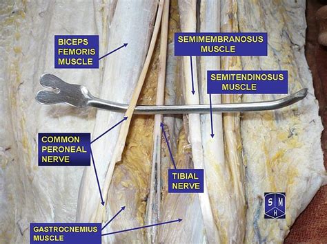 Filetibial Nerve And Common Peroneal Nerve Wikipedia