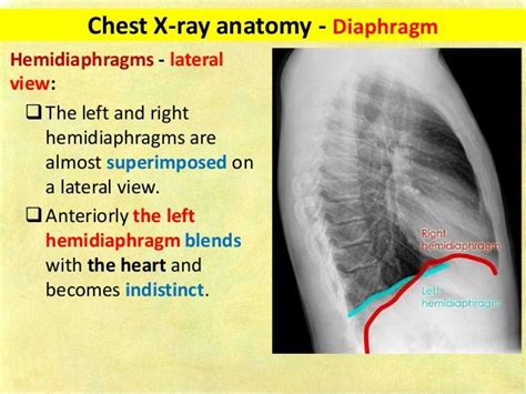 Chest X Ray Anatomy Diaphragm Hemidiaphragms Lateral View The Left