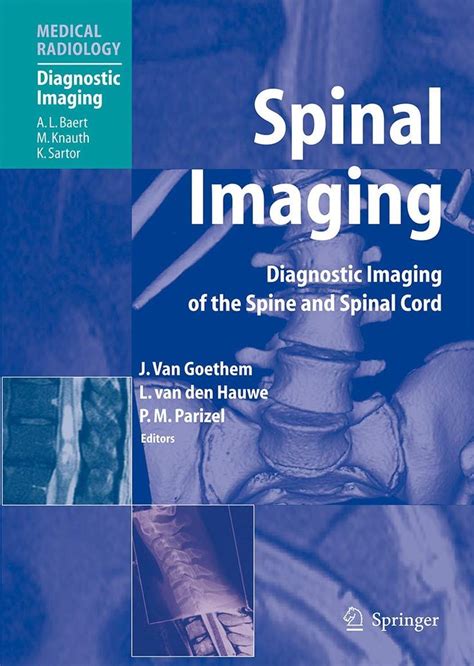 Spinal Imaging Diagnostic Imaging Of The Spine And Spinal Cord