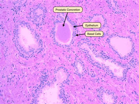 Human Epithelial Cells Under Microscope Labeled Micropedia