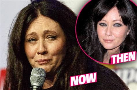 Shannen Doherty Reveals Wrinkled New Face — Inside Her Tragic Health