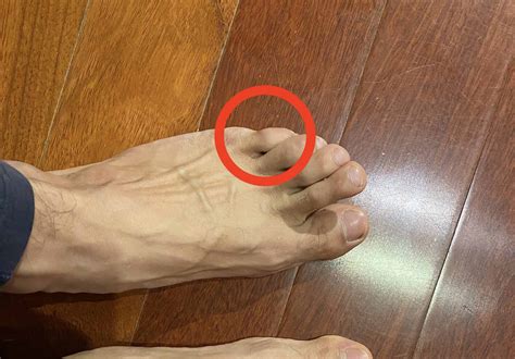 How To Move Your Pinky Toe Independently And Its Benefits Capoeira