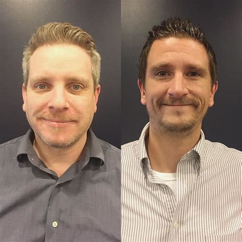 Here are the facts on this method and when it the most common side effects of bleaching, tobia says, are redness, itching, bumps, burning. An update on how #movember is going in the office... not ...