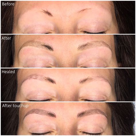 Prior to the microblading and after the consultation, i had an anesthetic cream on my eyebrows for about 30 minutes. Microblading - Before & After images - Eyebrow Doctor ...