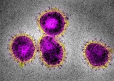 How Long Can Coronaviruses Survive On Surfaces