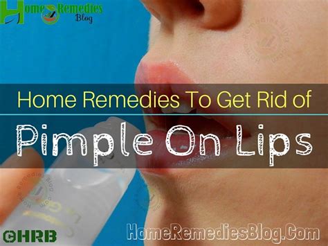 15 Home Remedies To Get Rid Of Pimple On Lip Naturally Home Remedies Blog