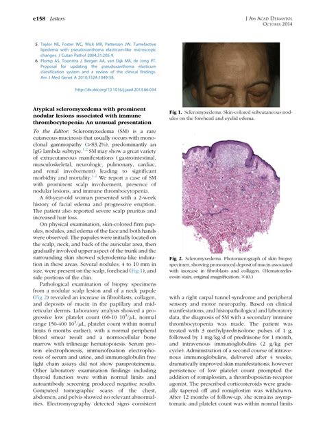 Pdf Atypical Scleromyxedema With Prominent Nodular Lesions Associated