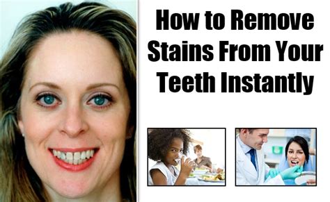 Before we get into the various method on whitening your coffee stained teeth, consider rinsing out your mouth with water every time you have. How To Remove Stains On Teeth Instantly - Maintain White ...