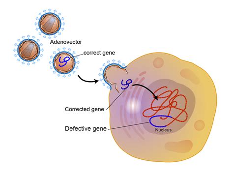 Gene Therapy