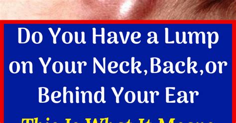 Do You Have A Lump On Your Neckbackor Behind Your Ear This Is What It