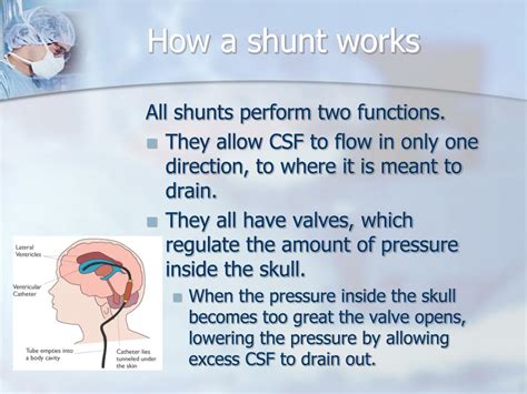 Ppt Hydrocephalus And Shunts Powerpoint Presentation Free Download