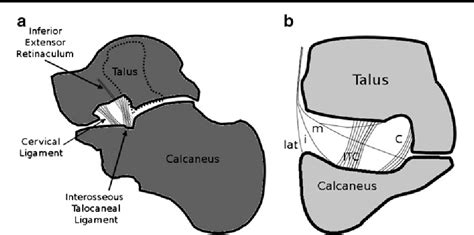 Ligaments Of The Tarsal Sinus Improved Detection Characterisation And