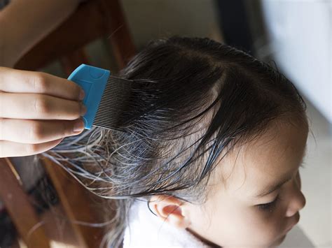 How To Tell If Your Child Has Head Lice Babycenter