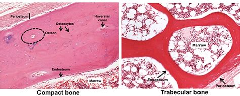 Trabecular Bone Vs Cortical Bone