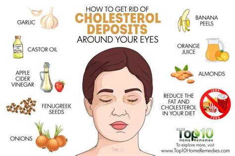 How To Get Rid Of Cholesterol Deposits Around Your Eyes Top 10 Home