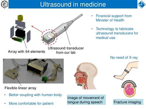 Artificial Heart And Applications Of Ultrasound In Medicine