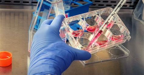 The swiss medical weekly paper9 also reviews the evidence of ade in coronavirus infections, citing research showing inoculating cats against the feline infectious. Russia Claims Sputnik V Vaccine Success, Mass Vaccinations ...