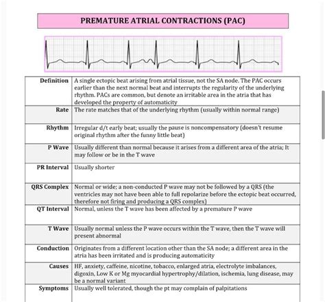 Dysrhythmia Cheat Sheet