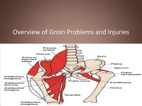 Groin Pain Groin Injuries Symptoms Causes Treatment