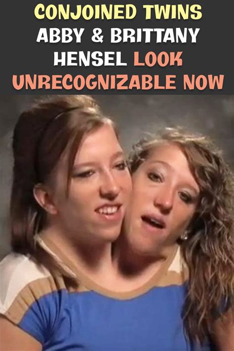 conjoined twins abby and brittany hensel look unrecognizable now conjoined twins gingham